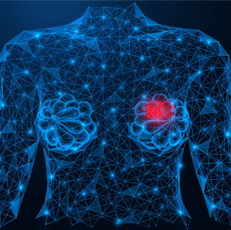 Липома молочной железы: полное руководство по диагностике и лечению