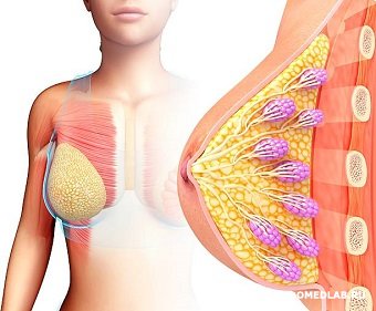 Дуктэктазия молочной железы: полное руководство по причинам и лечению