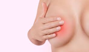 Галактоцеле молочной железы: полное руководство по диагностике и лечению