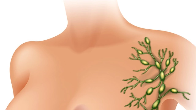 Лимфорея после операции на груди: причины, лечение и полное восстановление