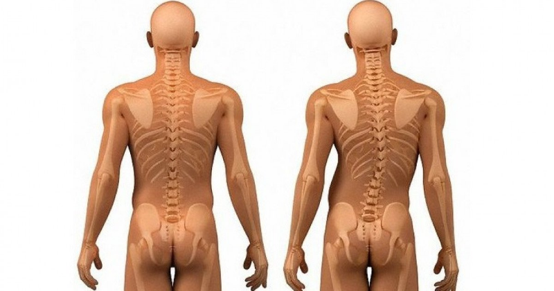 Мануальная терапия при сколиозе для восстановления здоровья позвоночника