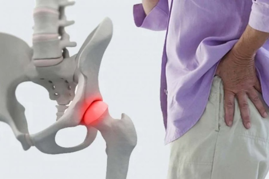 Мануальная терапия при коксартрозе для восстановления подвижности сустава
