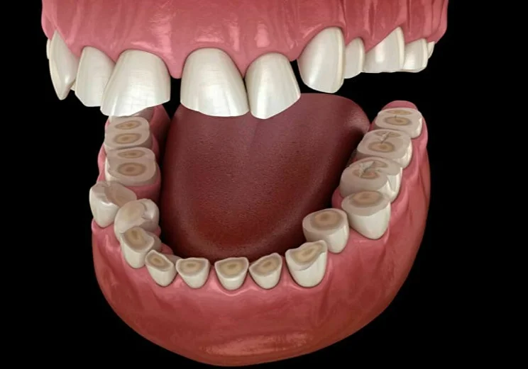 Мануальная терапия при бруксизме для снятия боли и напряжения в челюсти