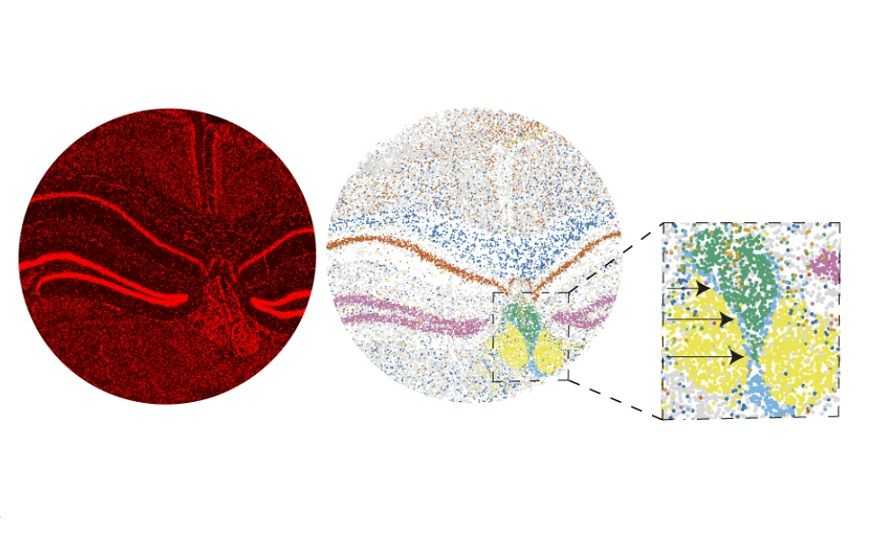 Экспрессивность гена: полное понимание механизма и его значения в медицине