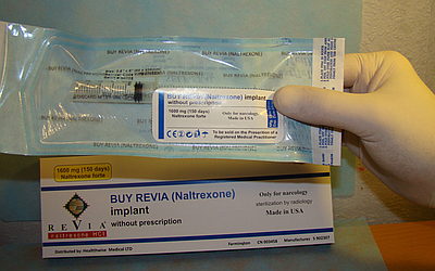 Имплант с налтрексоном для надежной блокады опиоидной зависимости