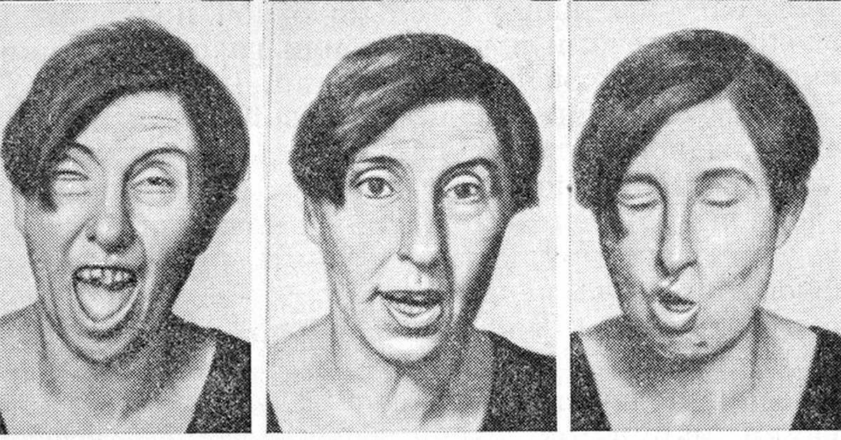 Болезнь Гентингтона: полное руководство по симптомам, лечению и поддержке