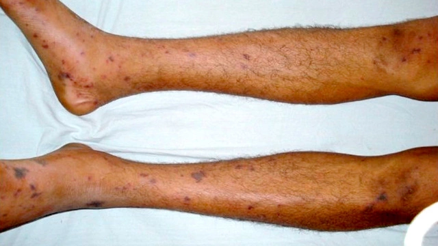 Менингит у взрослых: полное руководство по симптомам, лечению и защите