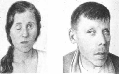 Нейросифилис: полное руководство по лечению и последствиям для нервной системы