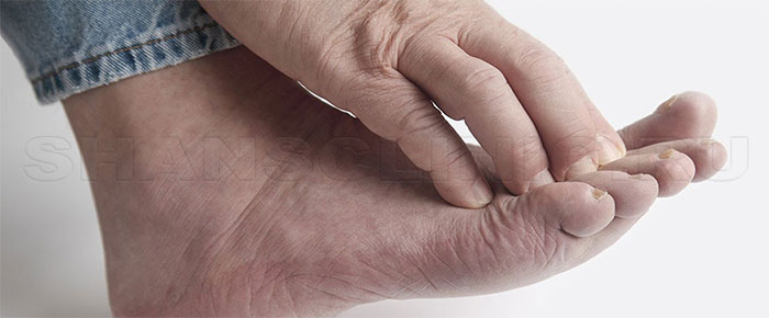 Алкогольная полинейропатия: как остановить повреждение нервов и вернуть чувствительность