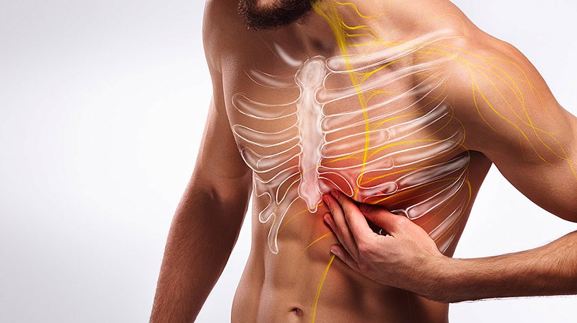 Межреберная невралгия: обретение контроля над болью и возвращение к жизни