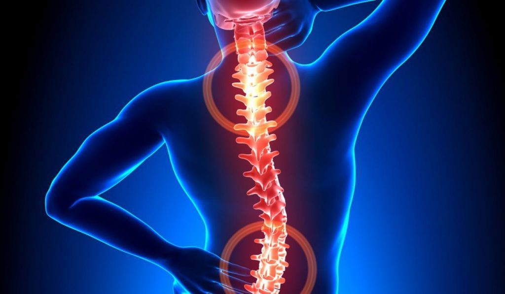 Остеохондроз позвоночника: полное руководство по симптомам и лечению