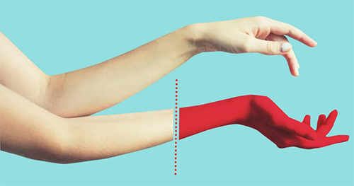 Фантомная боль после ампутации: полное руководство по причинам и лечению