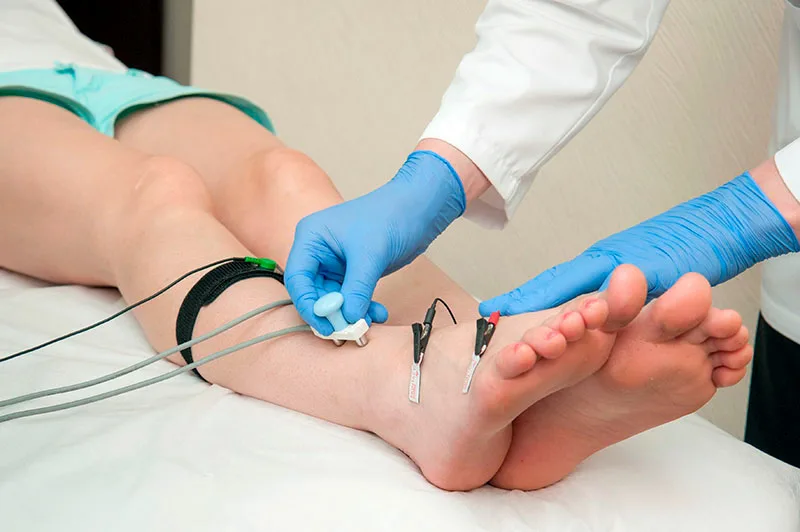 Электронейромиография (ЭНМГ): полное руководство по методу диагностики нервов