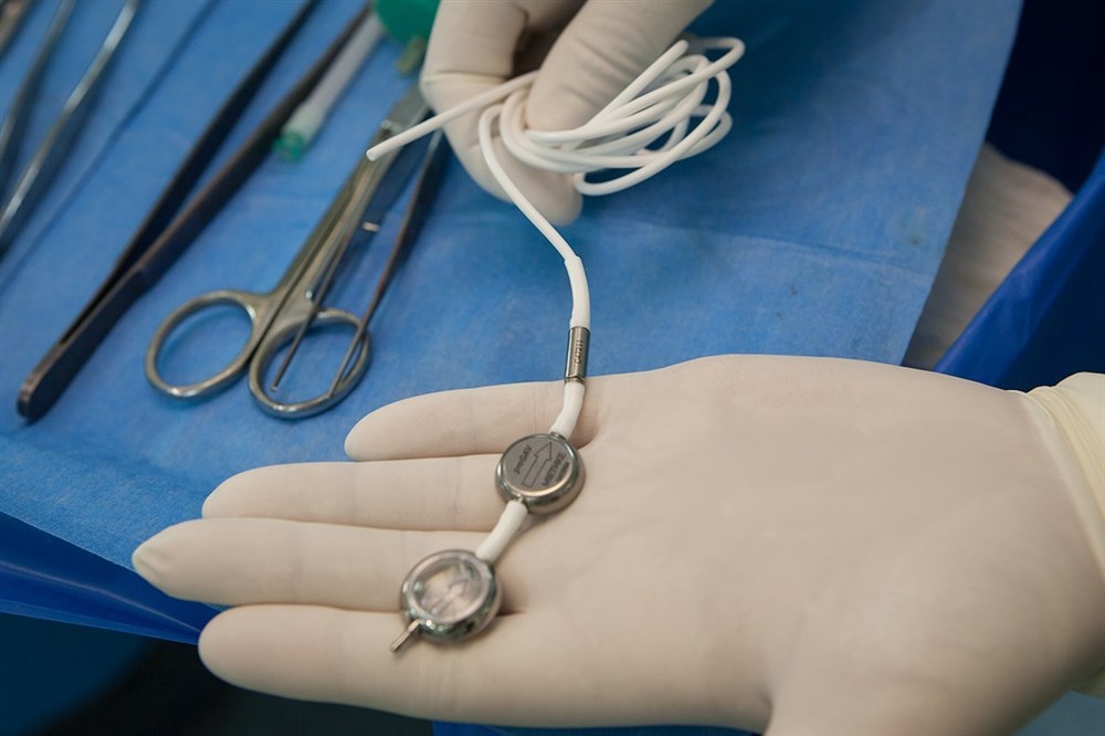 Вентрикулоперитонеальное шунтирование для лечения гидроцефалии у взрослых и детей