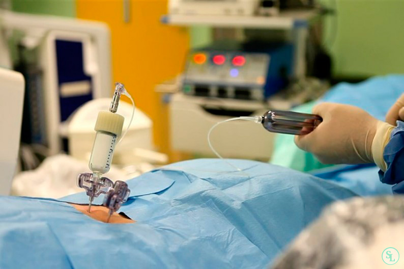 Кифопластика для восстановления позвоночника при компрессионных переломах