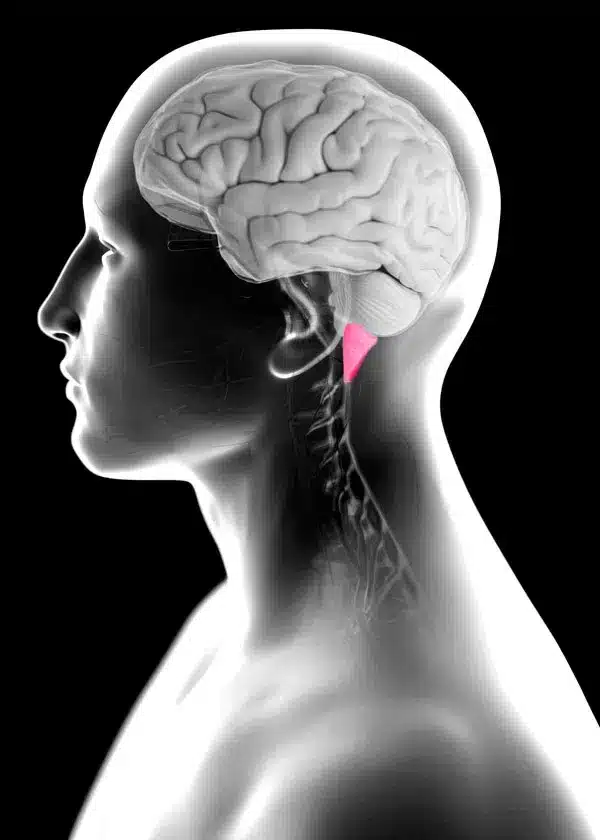 Мальформация Киари: обретение контроля над симптомами и будущим