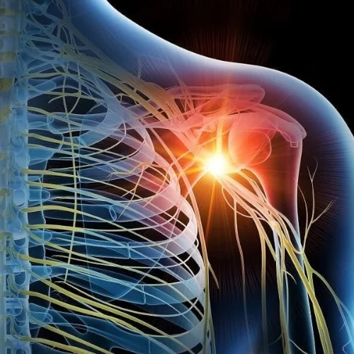 Восстановление функции руки после повреждения плечевого сплетения
