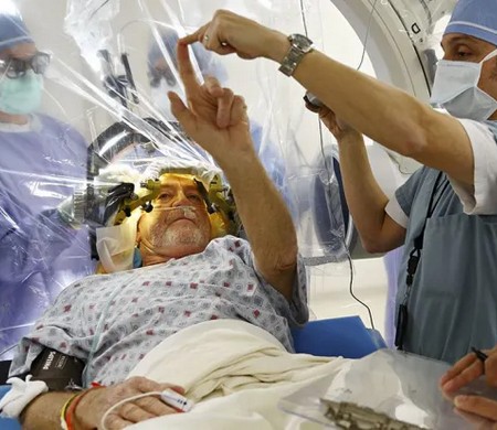 Таламотомия: полное руководство по нейрохирургической операции для контроля тремора