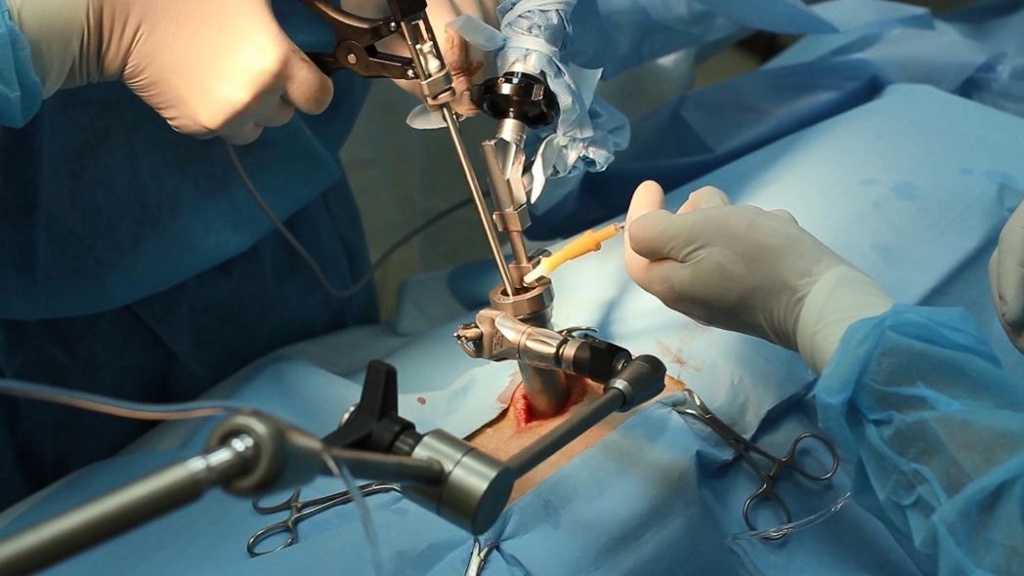 Эндоскопическая нейрохирургия как стандарт лечения заболеваний мозга и позвоночника