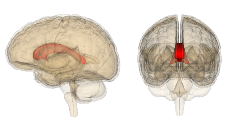 Каллозотомия: полное руководство по операции для контроля эпилепсии