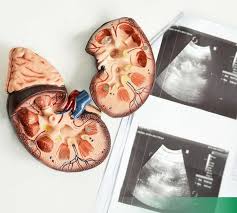 Поражение почек при АНЦА-васкулите: от симптомов до прогноза