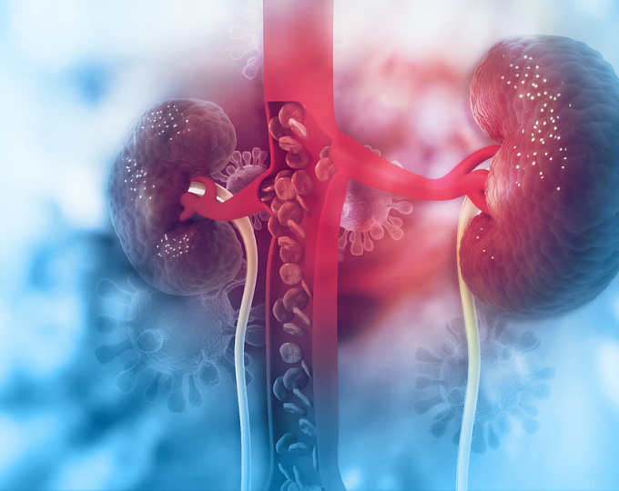 Ишемическая нефропатия: как сохранить здоровье почек при нарушении кровотока