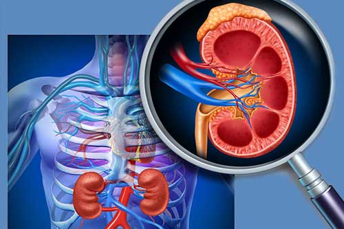 Тромбоз почечной вены: от причин до восстановления функции почек