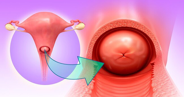 Рак шейки матки: полное руководство по диагностике, лечению и прогнозу