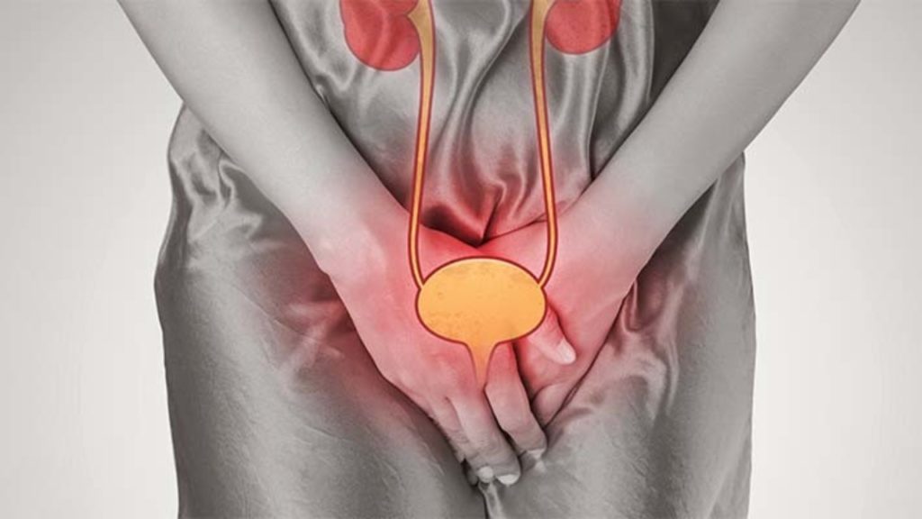 Рак уретры: полное руководство по диагностике, лечению и прогнозу