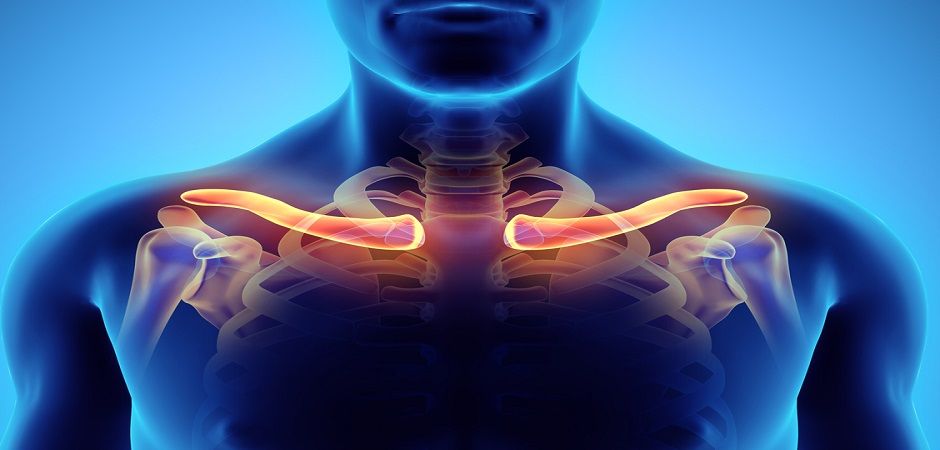 Артроз акромиально-ключичного сустава: как вернуть движение без боли