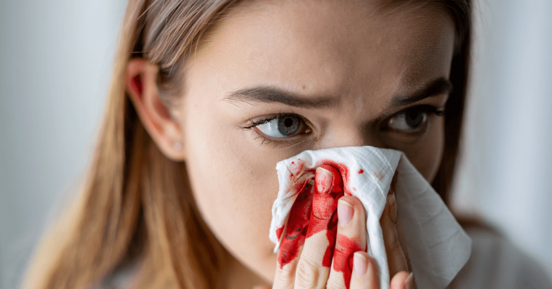 Носовое кровотечение: полное руководство по причинам, лечению и профилактике