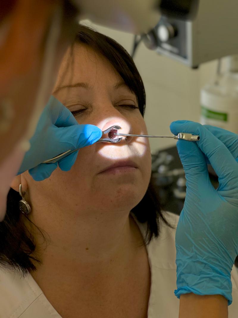 Киста верхнечелюстной пазухи: полное руководство по диагностике и лечению