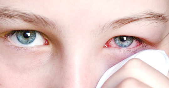 Дакриоцистит: причины, симптомы, диагностика и лечение у взрослых и детей