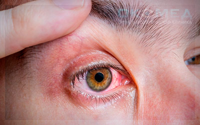 Инородное тело в глазу: что делать, как удалить и избежать осложнений