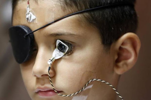 Электроретинография: полное руководство по диагностике заболеваний сетчатки