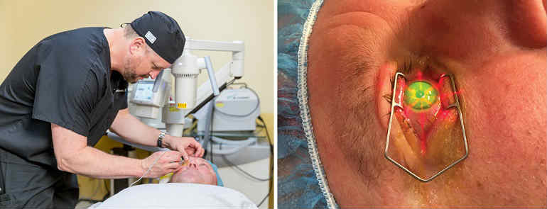 Кросс-линкинг роговицы: остановите прогрессирование кератоконуса навсегда