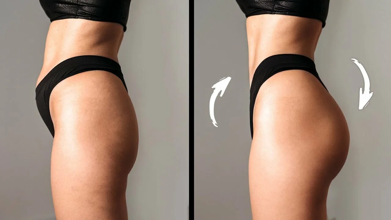 Глютеопластика для гармоничной фигуры: полное руководство по пластике ягодиц