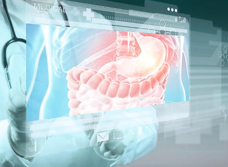 Аноректальная манометрия для точной диагностики работы кишечника и сфинктера