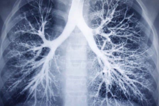 Бронхоэктатическая болезнь (БЭБ): как контролировать симптомы и жить полноценно