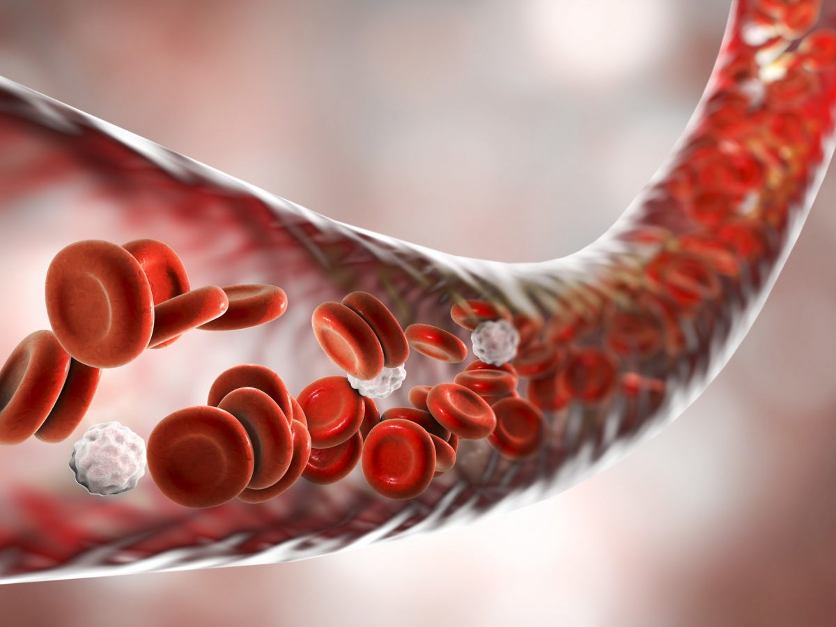 Микроскопический полиангиит (МПА) с поражением легких: полное руководство для пациентов