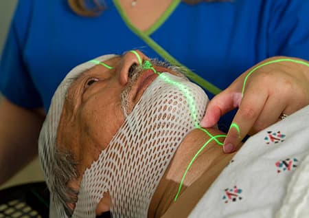 Радиотерапия рака носоглотки и ротоглотки: полное руководство по лечению