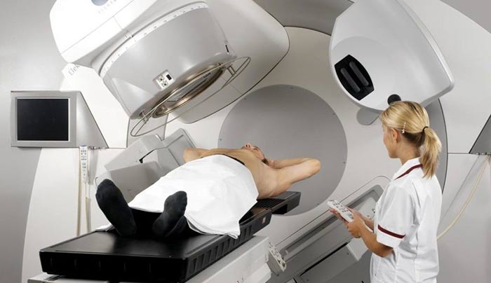 Радиотерапия рака анального канала: полное руководство от диагностики до восстановления