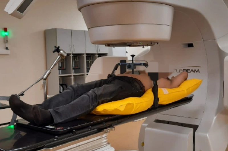 Радиотерапия рака печени: методы, эффективность и полное руководство