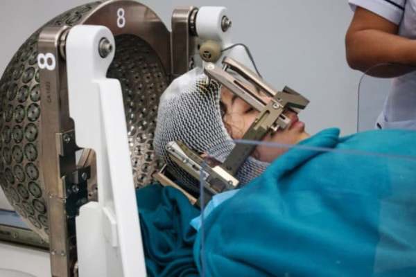 Стереотаксическая лучевая терапия: полное руководство по инновационному методу лечения рака