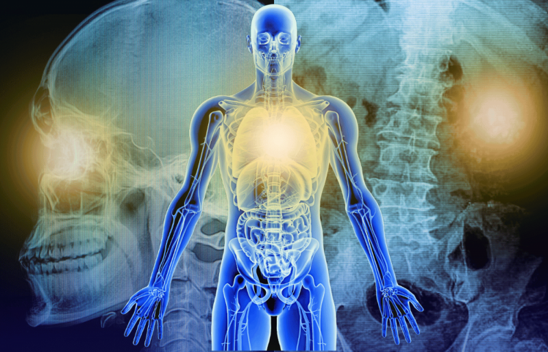 Тотальное облучение тела (TBI): комплексная подготовка к пересадке костного мозга