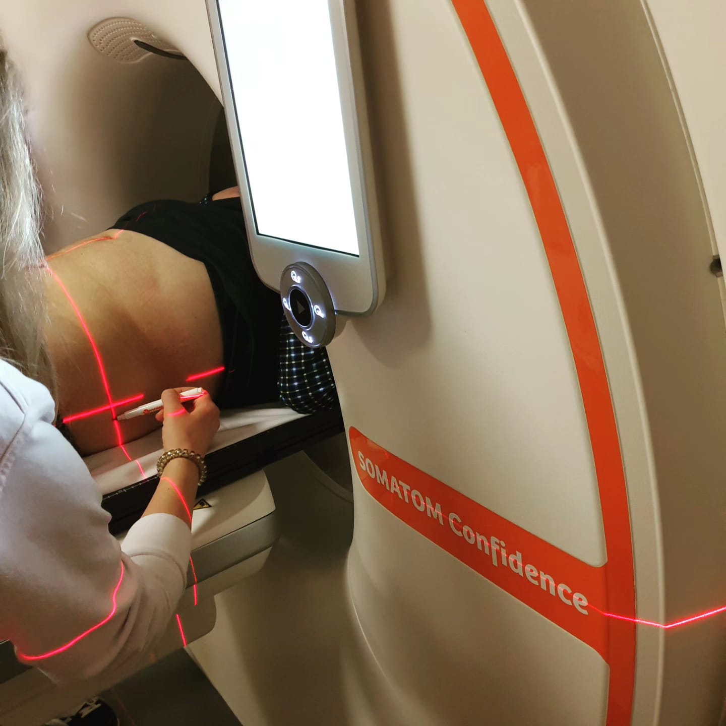 Гипофракционирование в радиотерапии: полное руководство по сокращению сроков лечения