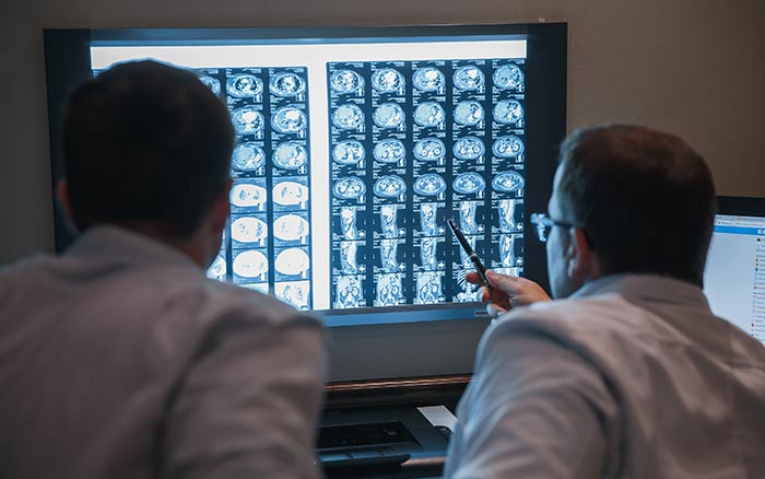 Лучевая терапия при множественной миеломе: полное руководство по методам и показаниям