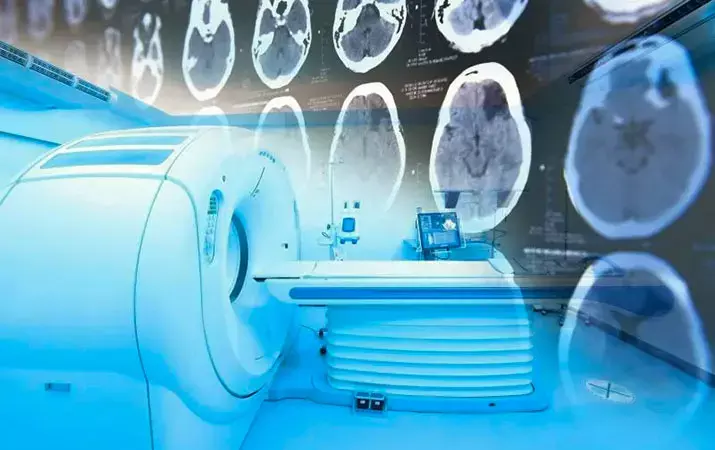 Защита критических органов при лучевой терапии: полное руководство