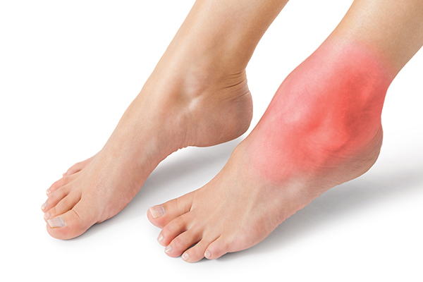 Реактивный артрит: полное руководство по диагностике, лечению и профилактике