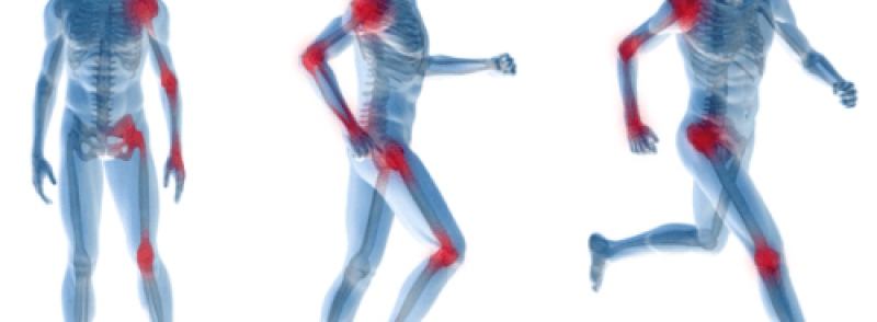 Ревматическая полимиалгия (РПМ): полное руководство по симптомам, диагностике и лечению